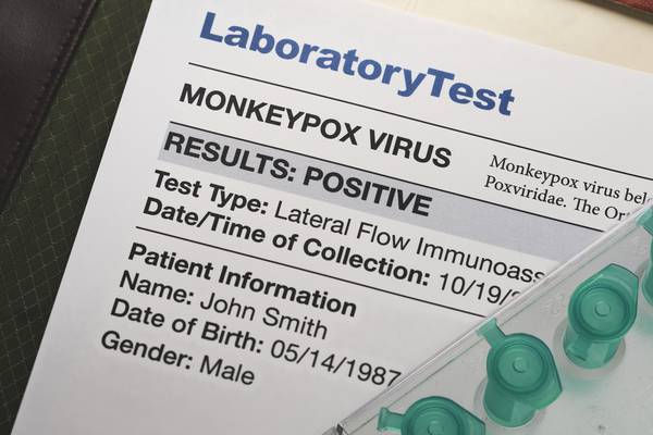 Monkeypox: Roche, Abbott developing tests for virus