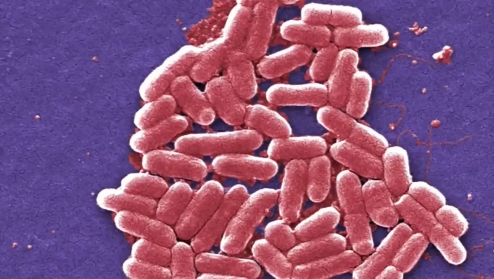 15 now infected multicounty E. coli outbreak linked to yogurt KIRO 7