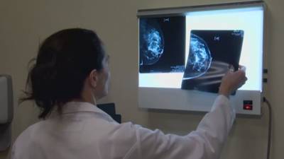 Doctors change mammogram screening recommendations in hopes of saving lives