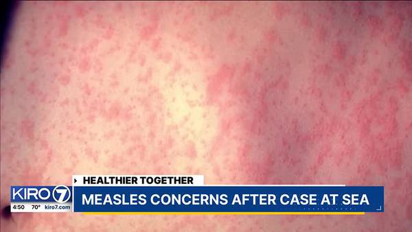 Healthier Together: Health officials sound alarm on measles