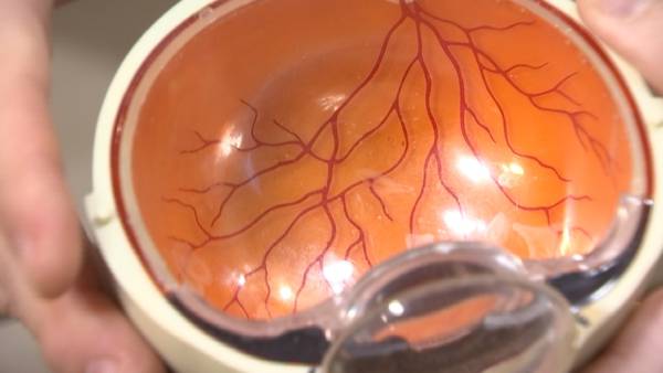 African-Americans at high risk for glaucoma, others at risk, too