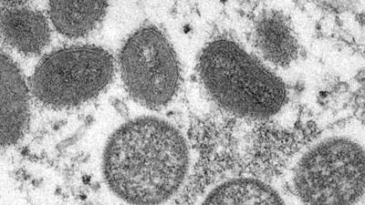 CDC warns about monkeypox