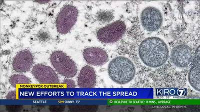 Monkeypox cases doubling each week in Washington state