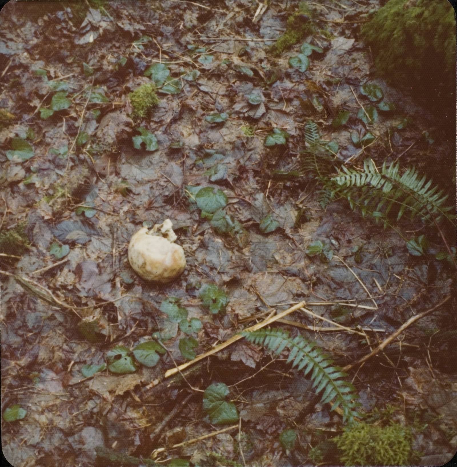 Autopsy Photos Of Ted Bundy