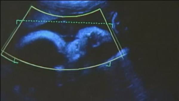 VIDEO: UW bioethicist explains new embryo testing study