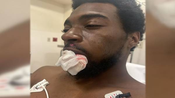 ‘My life literally flashed before my eyes:’ Tacoma man survives after being shot in face