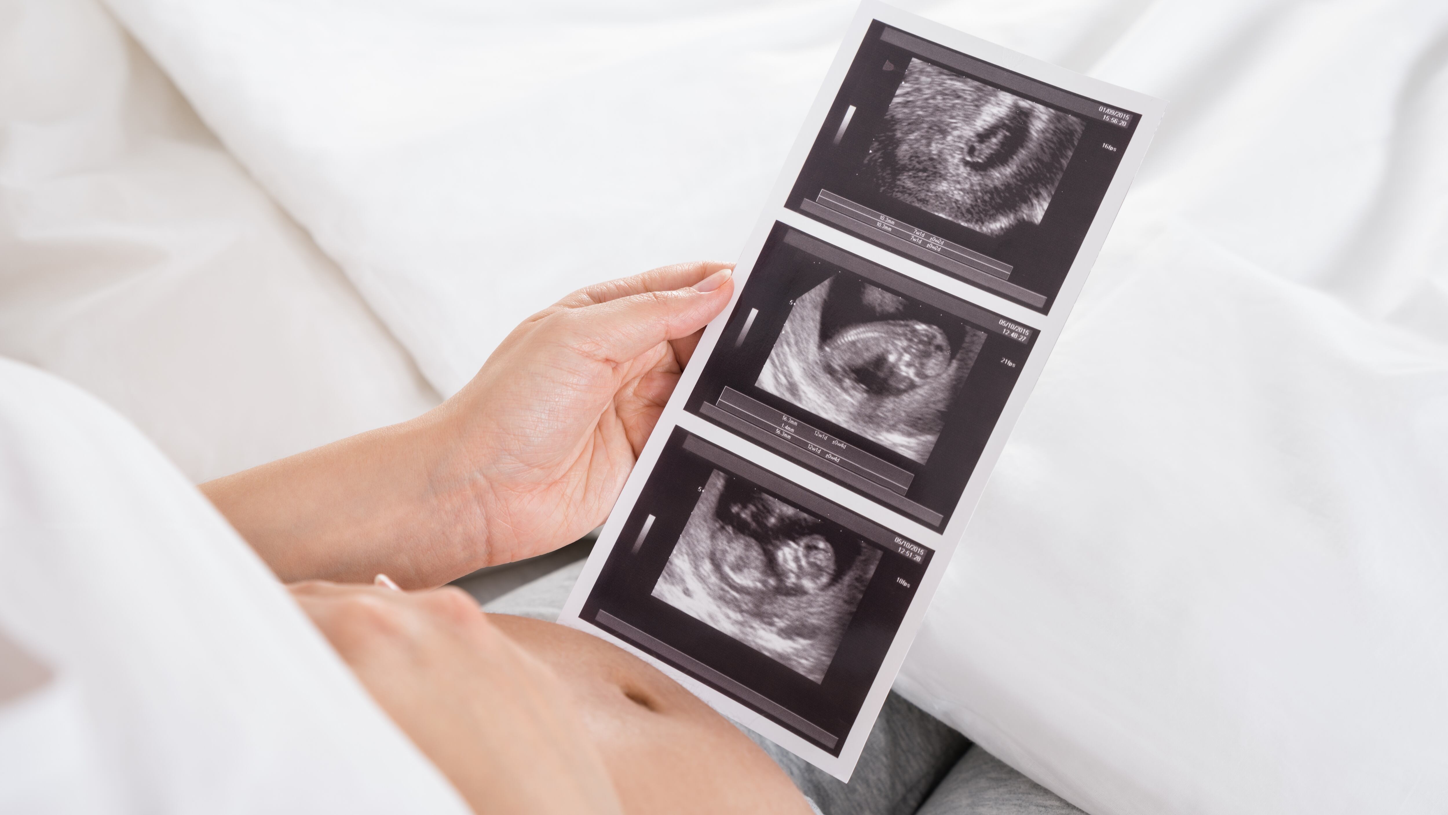 Pregnant Woman With Ultrasound Image Of Baby Sitting On Bed In Her Apartment
