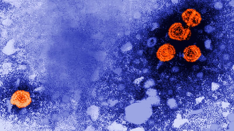 US awards no-bid contract to Denmark scientists studying hepatitis B vaccine in African babies