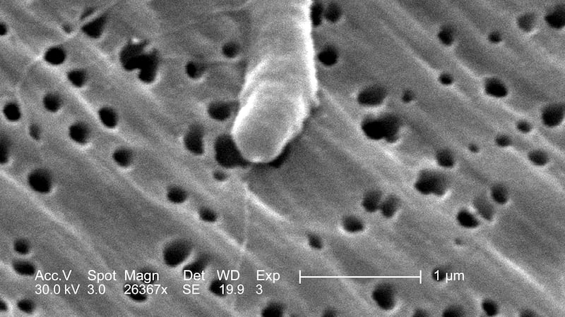 Flesh-eating bacteria kills 4; what is Vibrio vulnificus