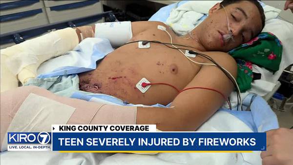 Auburn mom spreading awareness after son severely injured in fireworks accident Sunday